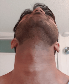 shave neck stubble